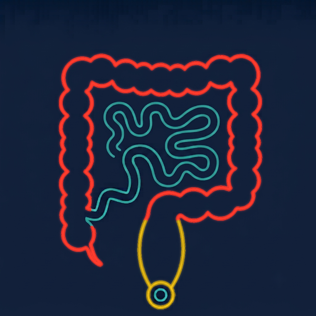 Illustration of Crohn's coloproctitis — large-bowel and rectal inflammation